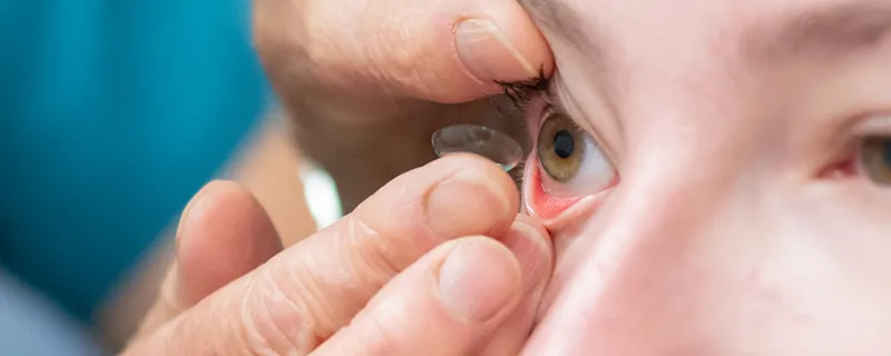 Contact Lens FAQ